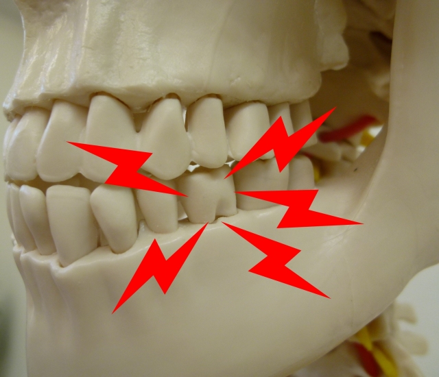 歯と骨